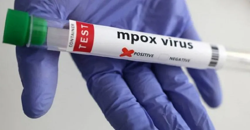 mpox 