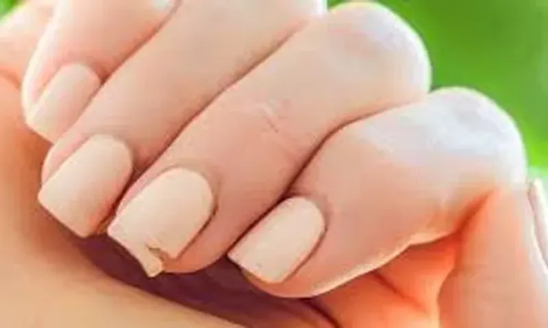શું તમારા નખ પણ વારંવાર તૂટી જાય છે? તો અપનાવો આ ઉપાય, નખ રહેશે એકદમ હેલ્ધી......