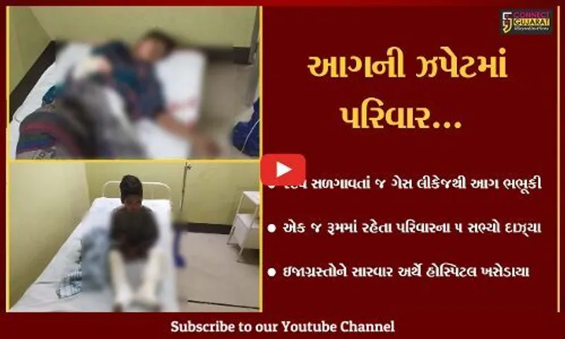 સુરત : ગેસ લીકેજના કારણે સ્ટવમાં થયો ભડકો, એક જ પરિવારના 5 સભ્યો દાઝ્યા...