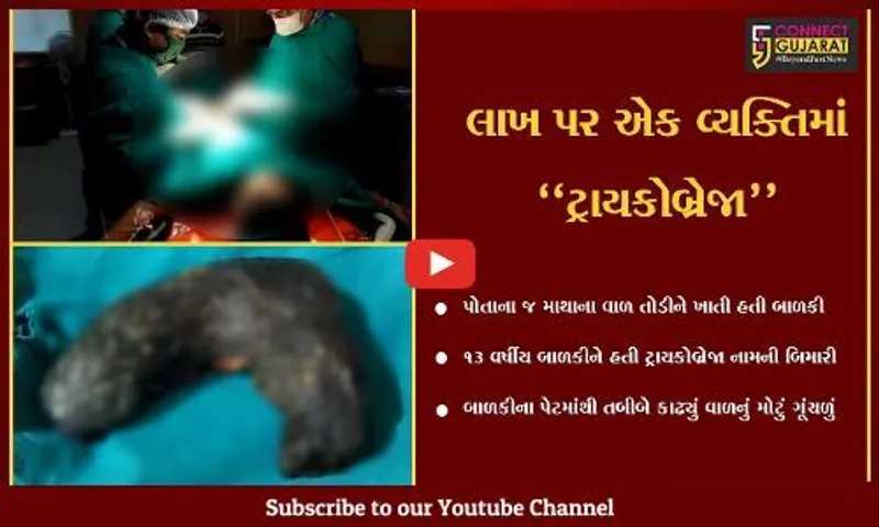 સાબરકાંઠા : બાળકીને હતી માથાના વાળ ખાવાની કુટેવ, જુઓ પછી પેટમાં દુ:ખાવો ઊપડતાં શું થયું..!