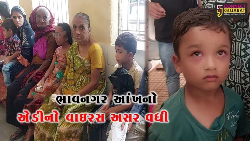 ભાવનગર: આંખના વાયરસની અસર અતિતીવ્ર ગતિએ વધી, રોજના નોંધાય રહ્યાં છે 100 કેસ