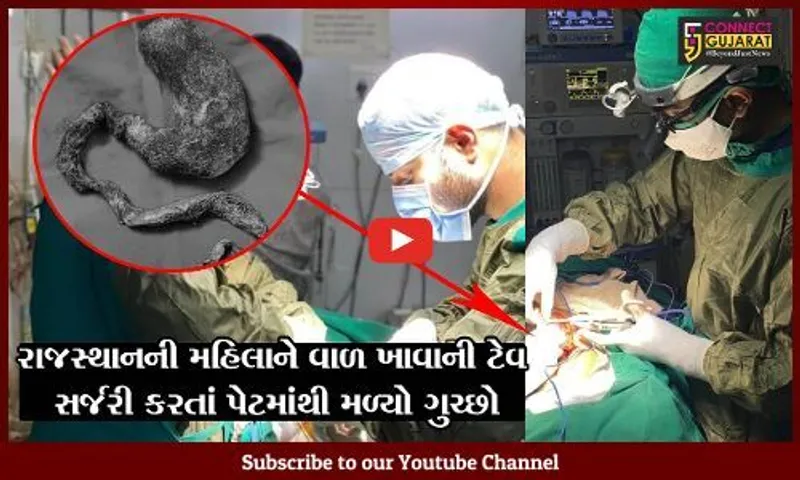 બનાસકાંઠા : મહિલા 20 વર્ષથી પોતાના જ વાળ તોડી ખાતી હતી, સર્જરી કરતાં પેટમાંથી મળ્યો ગુચ્છો