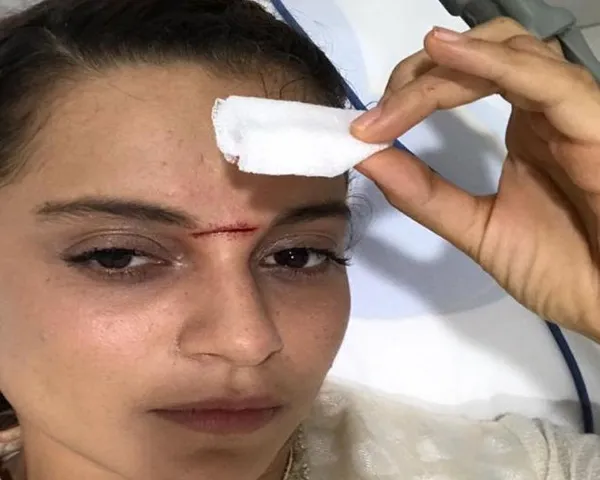 મણિકર્ણિકાના શુટિંગ દરમિયાન અભિનેત્રી કંગના રનૌતને વાગી તલવાર