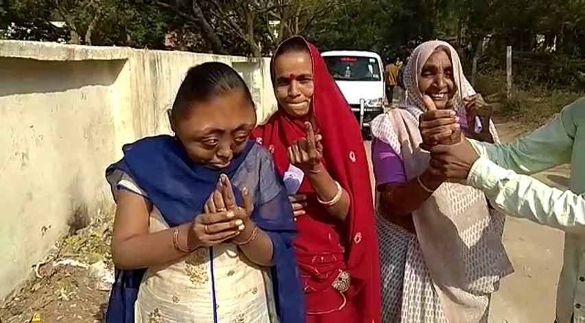 વડોદરા નંદેસરી ગામની પ્રોજેરિયા થી પીડિત યુવતી મતદાન કરીને બની પ્રેરણારૂપ