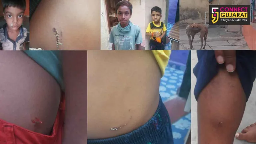 ભરૂચ : કોઠીરોડ વાલ્મિકી વાસ ખાતે  શેરીમાં રખડતા સ્વાને મચાવ્યો આંતક : ૫ બાળકો,૩ મોટા ઘાયલ