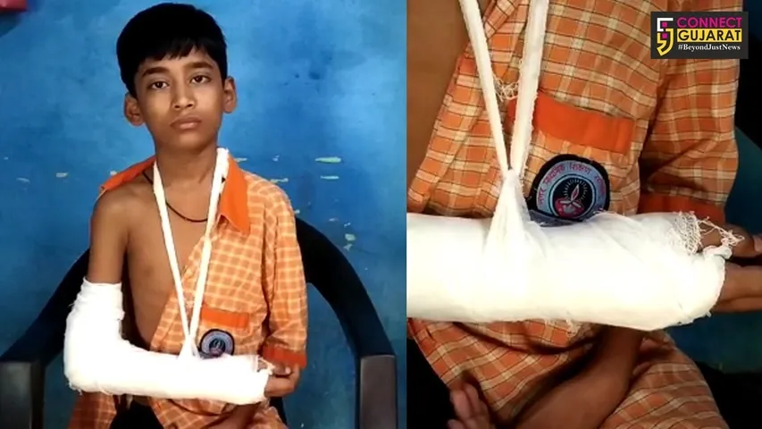 સુરત મનપા સંચાલિત શાળામાં શિક્ષક દ્વારા વિધાર્થીના હાથ પર મારતા ફેકચર