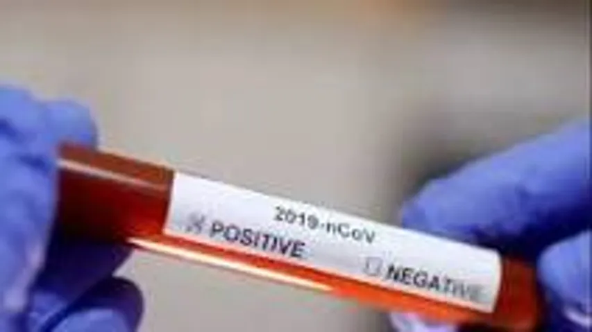 ભાવનગર જીલ્લામાં કોરોનાના આજે વધુ 58 નવા કેસ નોધાયા