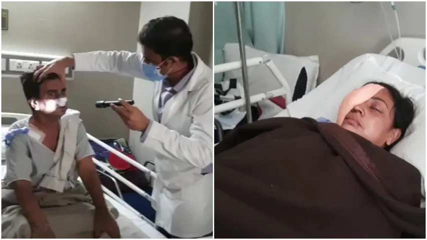 સુરત : મ્યુકોરમાઇકોસીસના 224 દર્દીઓ નોંધાયા, 16ના મોત, 67 સારવાર બાદ સાજા થયાં