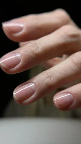 weak-nails (9)