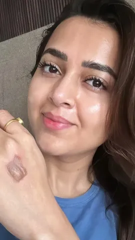 Tejasswi Prakash when she got hurt during the shoot of Celebrity Masterchef (11)