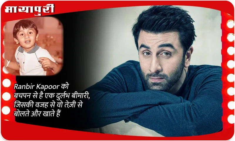 Ranbir Kapoor has a rare disease since childhood, due to which he speaks and eats fast