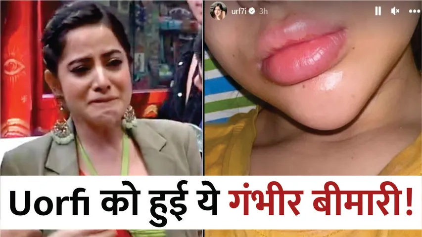 OMG! Actress Uorfi Javed जूझ रही हैं इस गंभीर बीमारी से