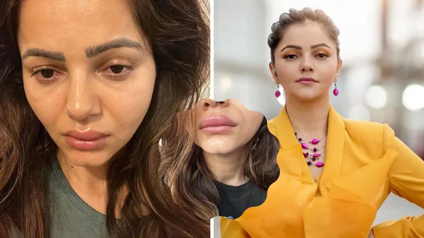 Rubina Dilaik