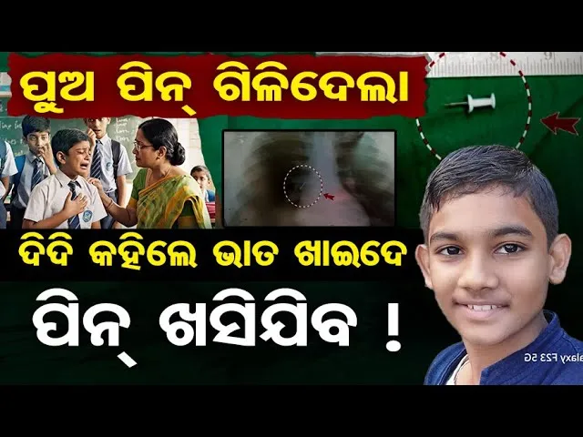 ପୁଅ ପିନ୍ ଗିଳିଦେଲା, ଦିଦି କହିଲେ ଭାତ ଖାଇଦେ ପିନ୍ ଖସିଯିବ ! | Kandhamal Shocking Incident |Odisha Reporter