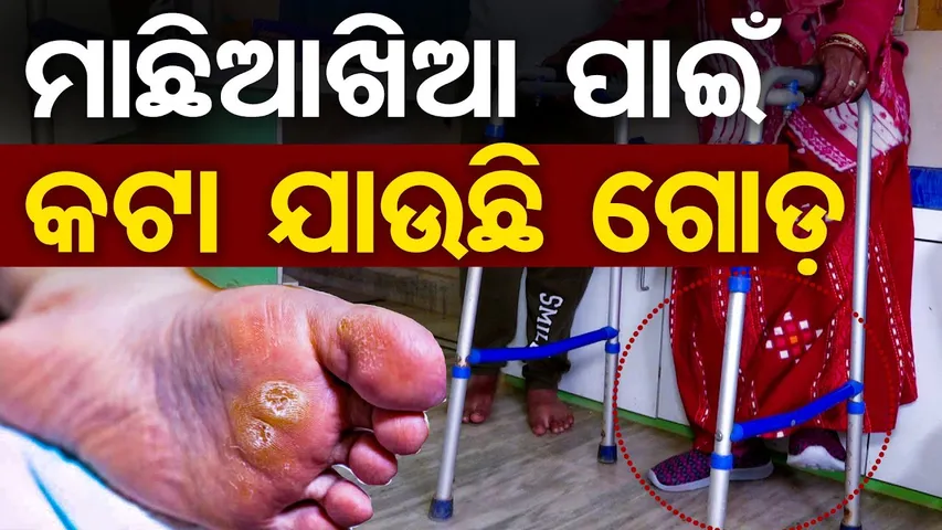ମାଛିଆଖିଆ ପାଇଁ କଟା ଯାଉଛି ଗୋଡ଼|| Health issues ||  Foot Infection Alert || Odisha Reporter