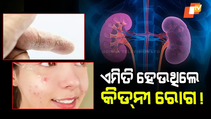 Early Signs of Kidney Disease