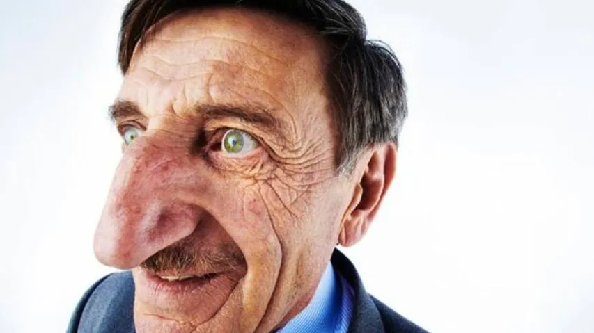 Worlds biggest nose