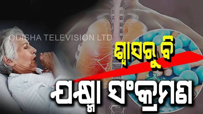 TB is caused by the breath of infected person