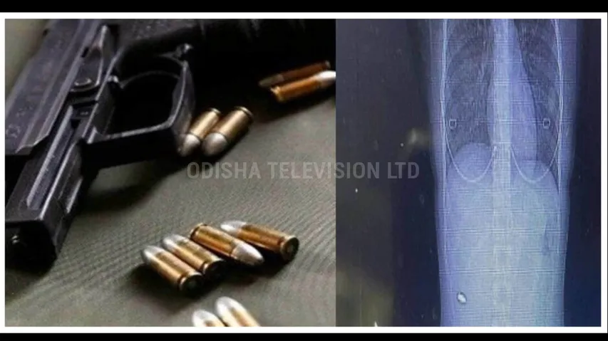 Strange woman living with bullet in back for 15 years know detail