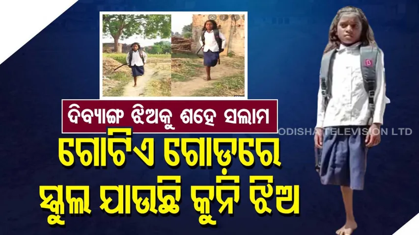 Bihar girl with one leg 