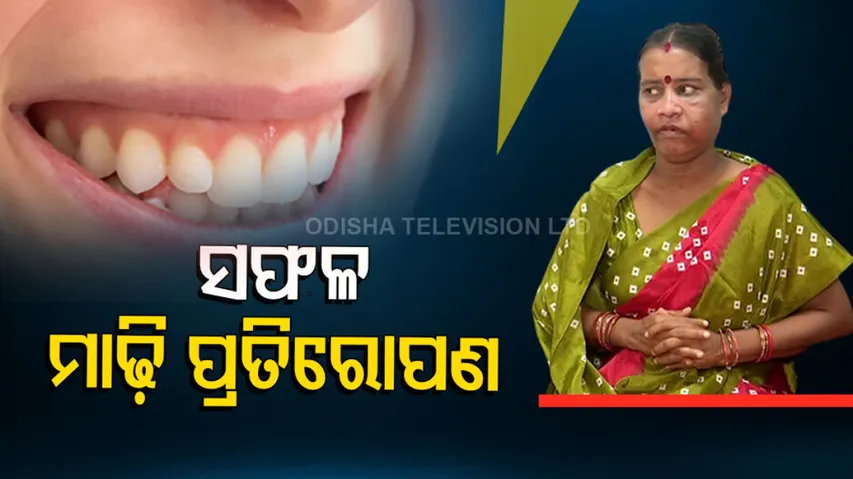 Cuttack SCB Medical doctors successfully perform Rare Surgery