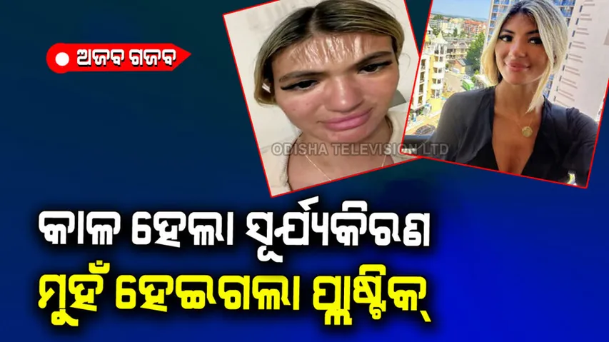 Woman sleeps in sun for 30 minutes wake up with plastic skin