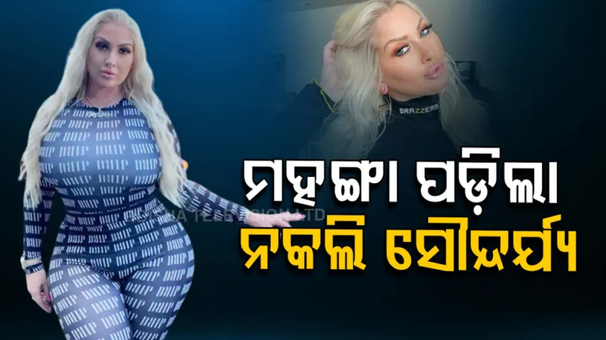 Woman Spent 40 Lakh On Plastic Surgery