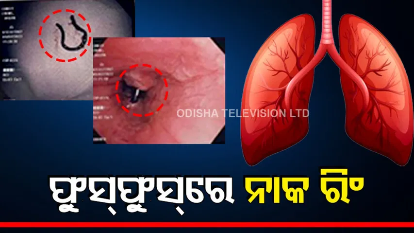 nose ring found in lungs