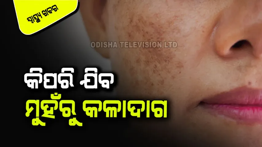 Treatment of black Spot on face after acne