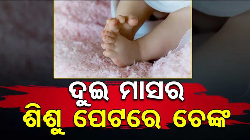 Quack Brands Two Month Old With Hot Iron Rod To Cure Cough