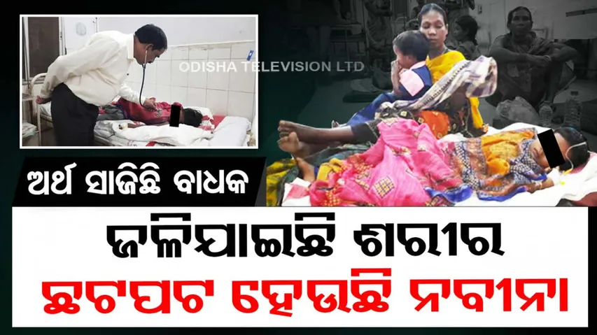 treatment of daughter with burn injuries