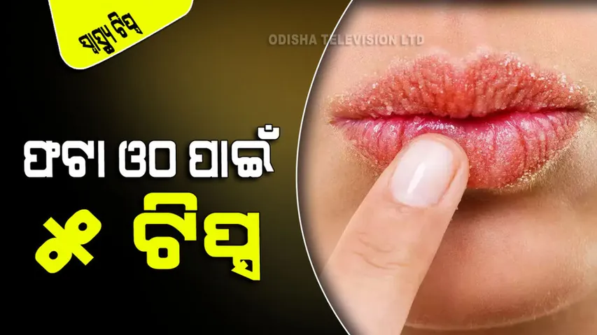 5 home remedies to get rid of chapped lips in winter