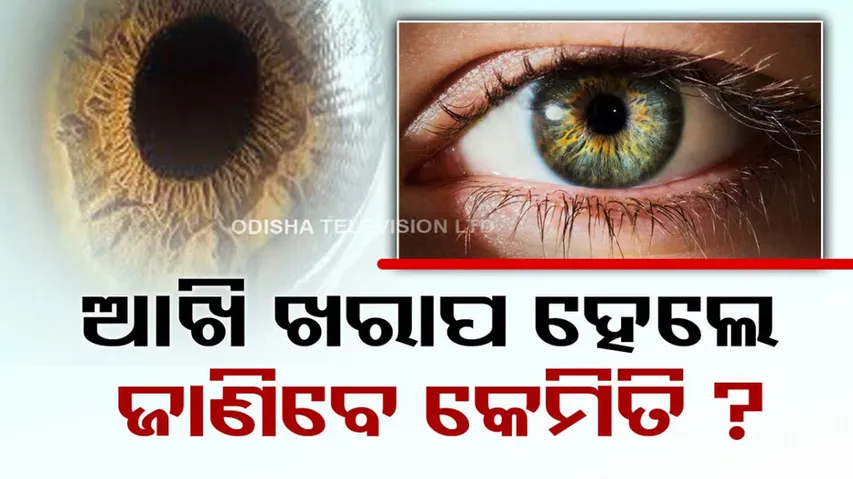 computer vision syndrome