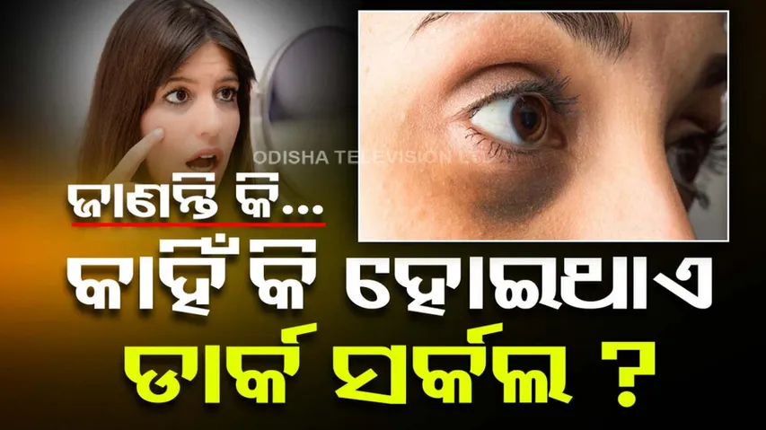 Dark Circles Home Remedies