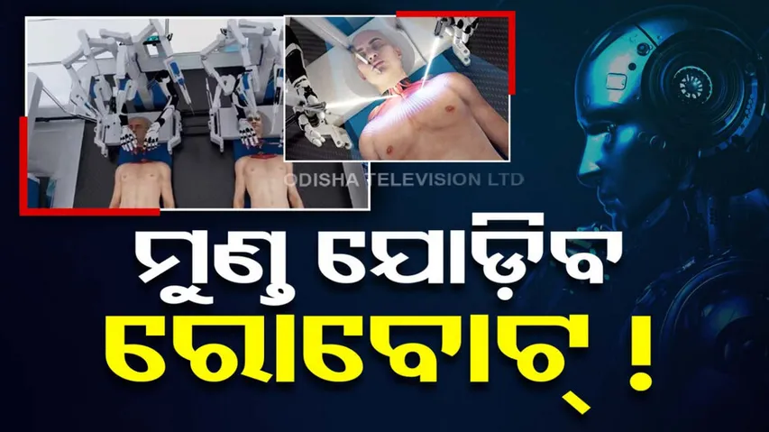 Viral Video: World's First Human Head Transplant By Robot