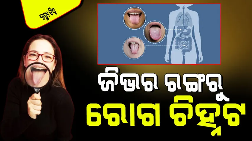 Changes in tongue color can indicate underlying health issue 