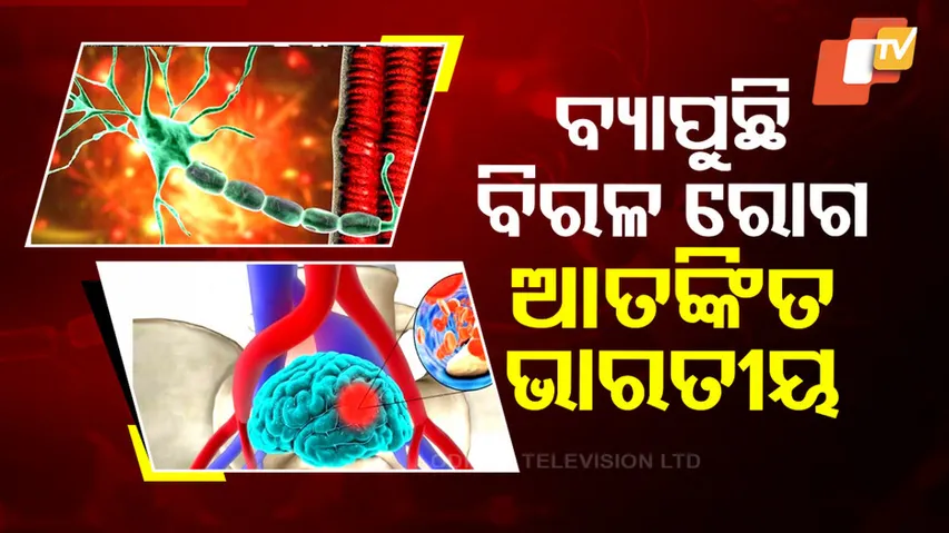 Guillain-Barre syndrome