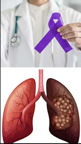  Health Tips: ଛାଡନ୍ତୁ ଏହି ୭ ଅଭ୍ୟାସ, ଛୁଇଁ ପାରିବନି କ୍ୟାନ୍ସର