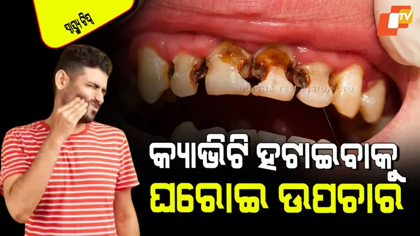 Home remedies to remove cavity from teeth