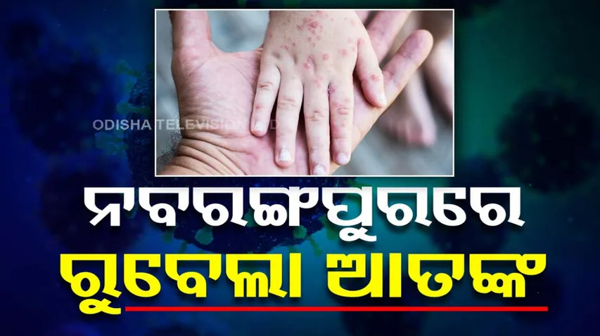 Rubella Cases Detected In Odisha's nabarangpur