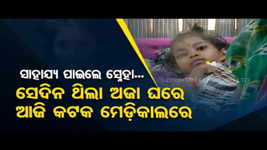 Apana Eka Nuhanti | OTV Impact | Deogarh girl with burn injuries receives treatment at Cuttack SCB