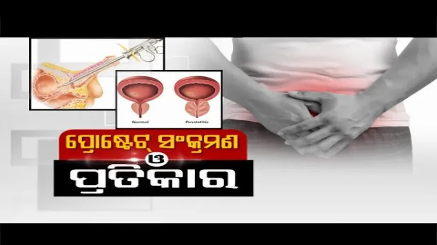 Doctor Doctor | Chronic Prostate & Treatment