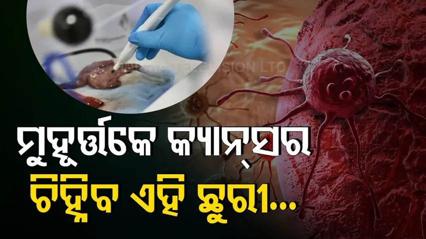 Intelligent Surgical Knife Can Detect Cancer Within Seconds