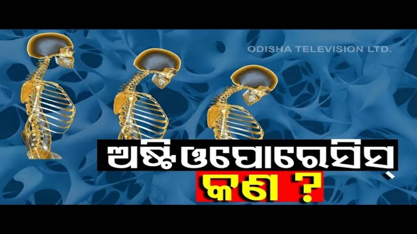 Doctor Doctor | Reasons & Cure Of Osteoporosis