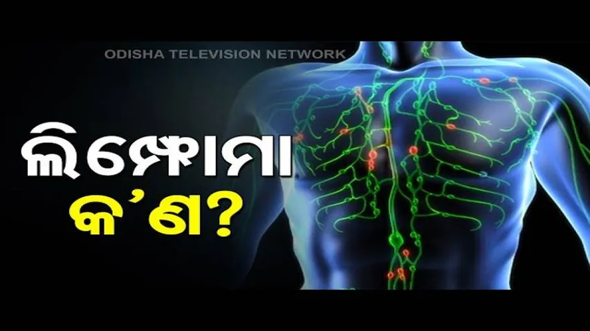 DOCTOR DOCTOR | Know More About Dreaded Disease Lymphoma With Dr Priyanka Samal