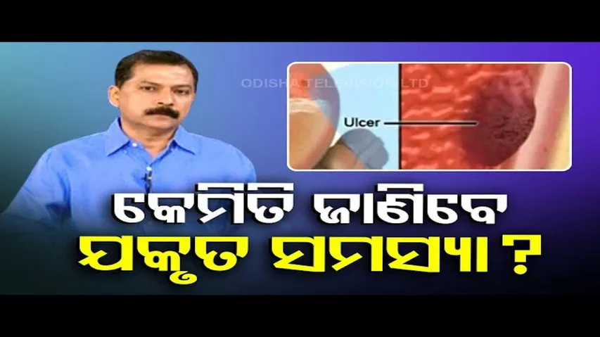 Doctor Dotor | How to take proper care of liver?