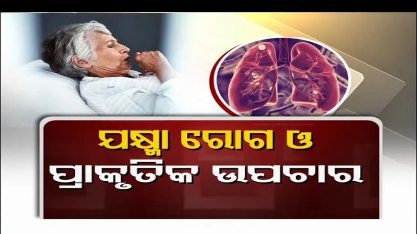 Doctor Doctor | Effective Home Remedies for Tuberculosis