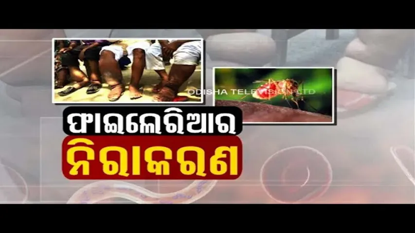 Doctor Doctor | What Is Filariasis ? - Causes, Symptoms, Diagnosis & Treatment