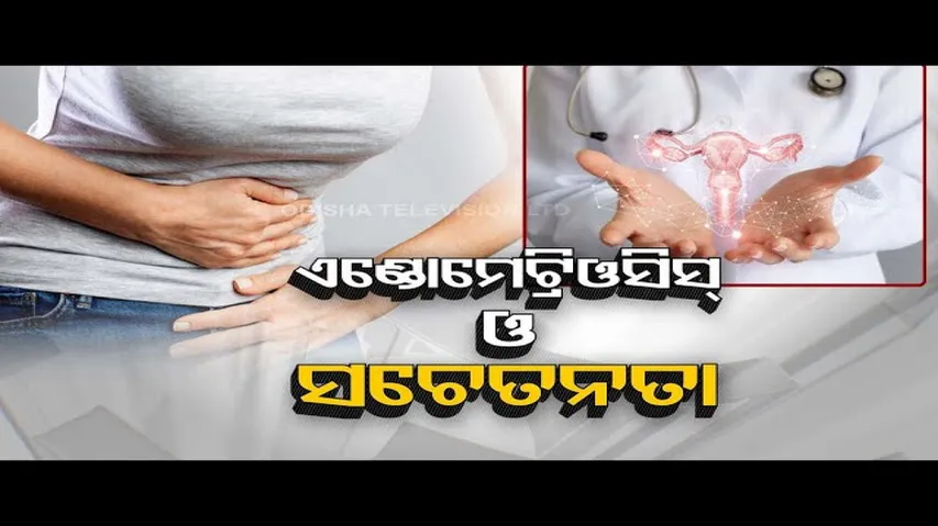 Doctor Doctor | Know what is Endometriosis