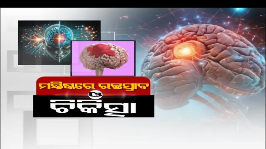 Doctor Doctor | Brain Hemorrhage : AI Treatments